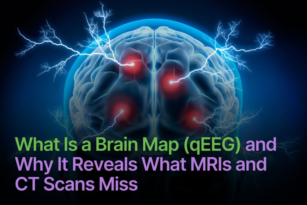 What Is a Brain Map (QEEG) and Why It Reveals What MRIs and CT Scans Miss?