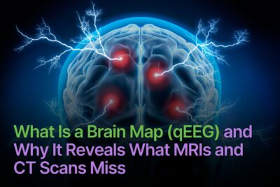 What Is a Brain Map (QEEG) and Why It Reveals What MRIs and CT Scans Miss?